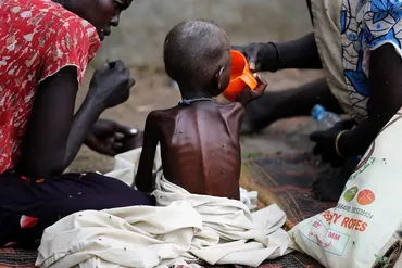 南スーダン:何週間も野草食べ 母「なぜ罪ない子供が…」